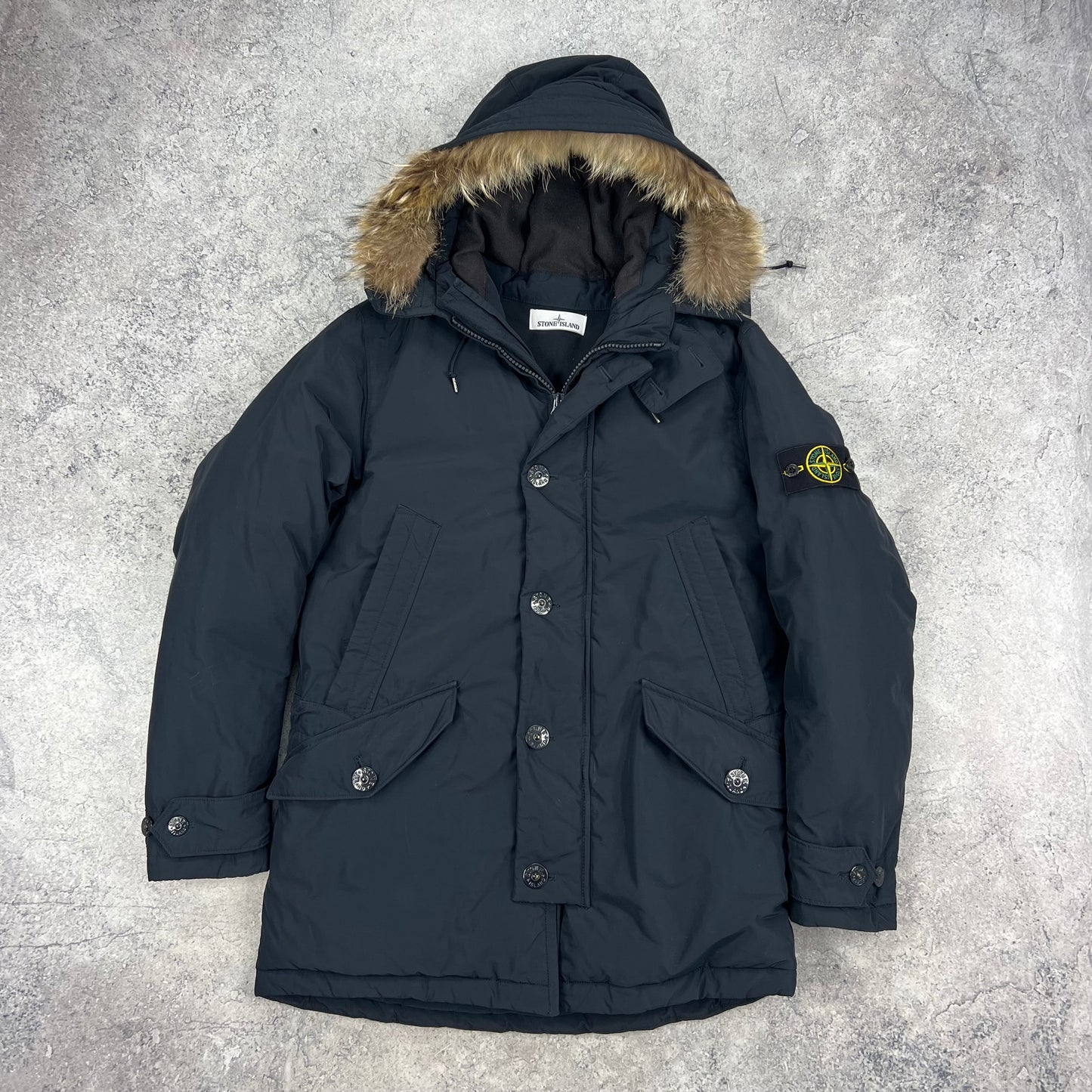 Stone Island Navy Micro Reps Down Parka Medium 23”